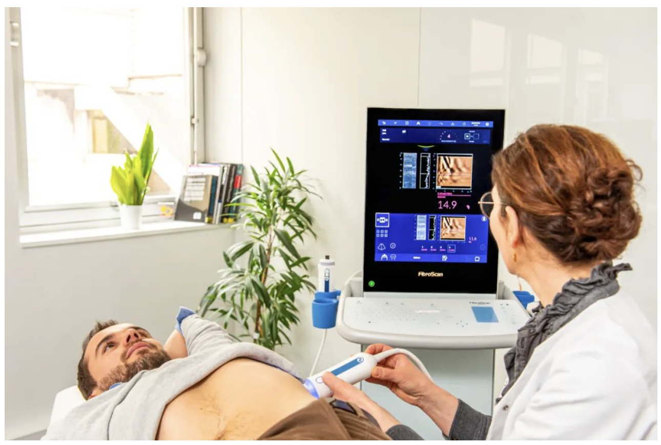 愛(ài)科森?學(xué)院專欄 | FibroScan?全球指南與共識(shí)推薦介紹（門靜脈高壓篇）